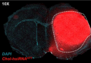 siRNA brain silencing 