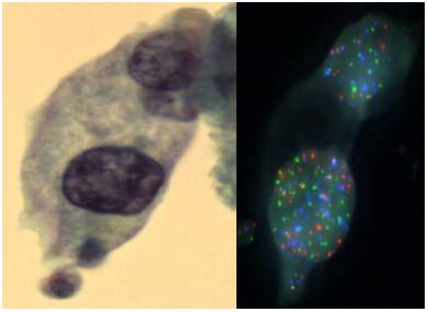 Diagnostic Molecular Oncology