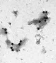 Double labeled cell membrane fragments