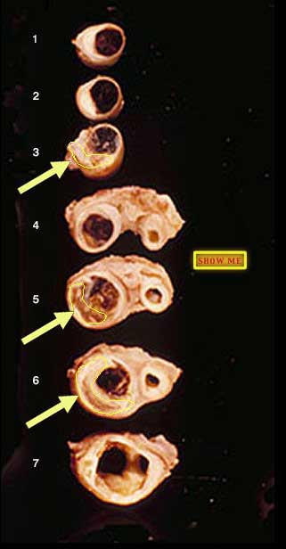 showing elongated unstained crystal-like profiles