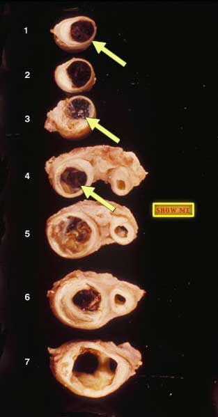 showing elongated unstained crystal-like profiles