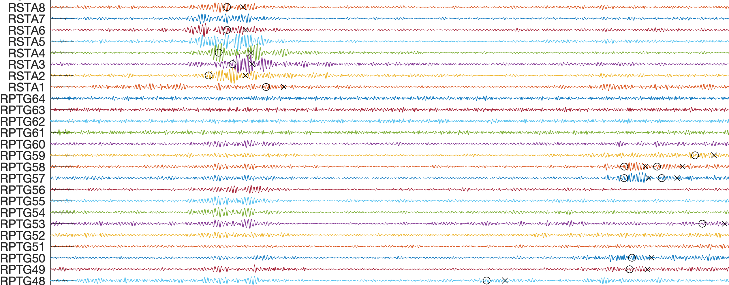 HFO detection.png