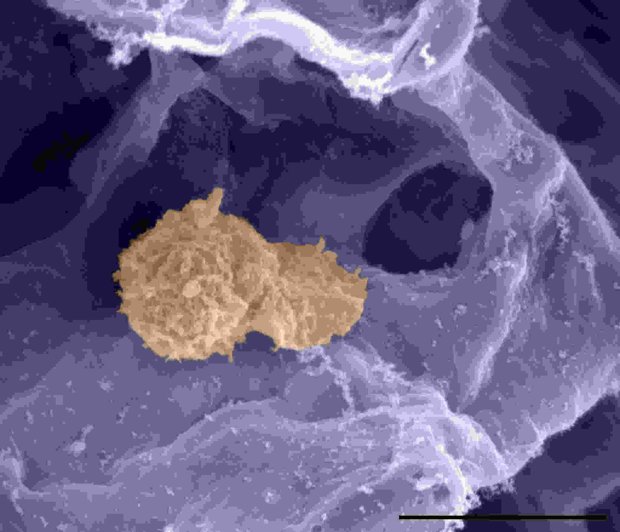 macrophage in lung