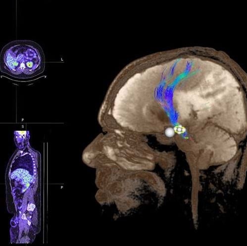 Integrated and Independent Interventional Radiology →