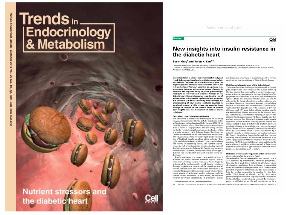 Research Heart Insulin Resistance