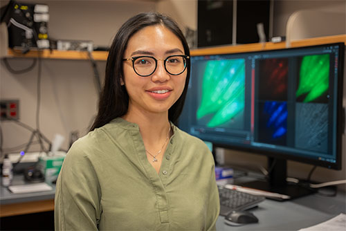 Photo of Samantha Tse, MD/PhD student at UMass Chan Medical School 