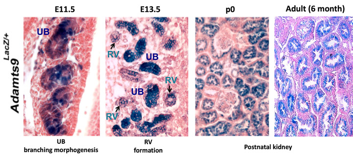 Kidney 1