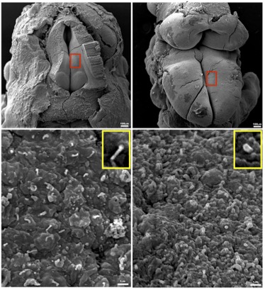 Neural Tube 2