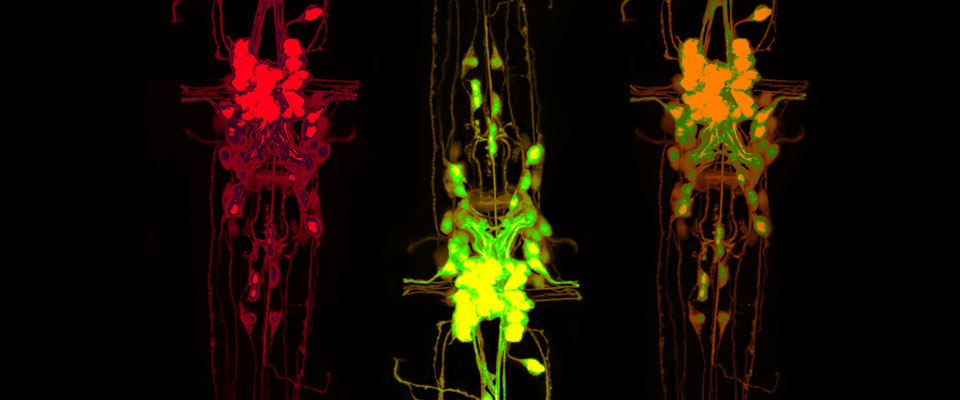 cholinergic neurons