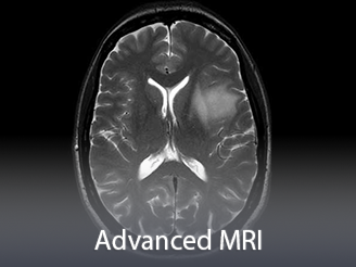  Cores-Advancedmri.png