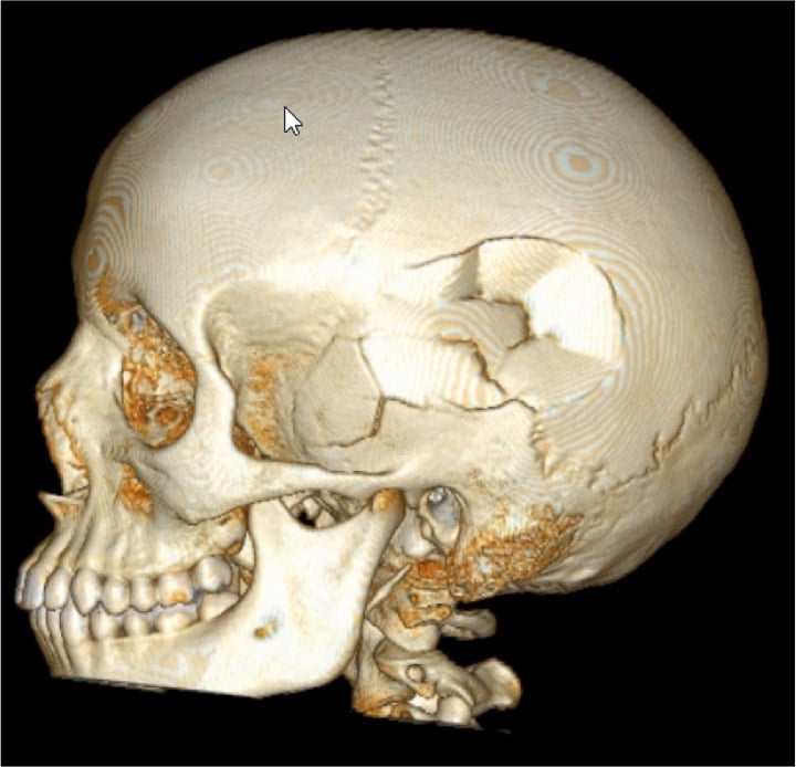 Neuroradiology