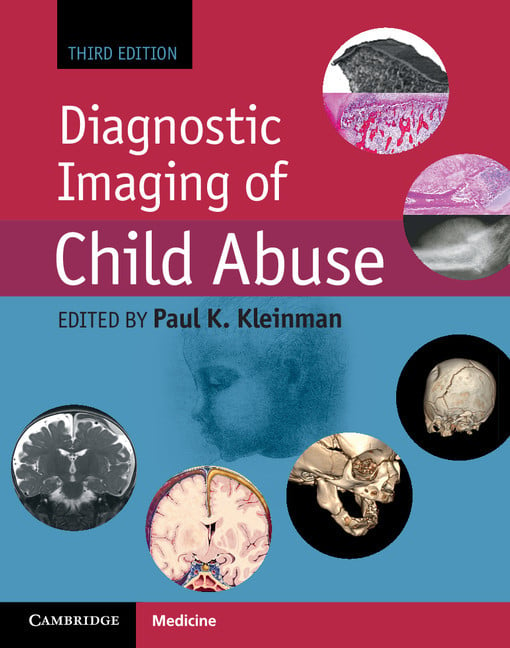 Diagnostic Imaging of Child Abuse 3rd Edition