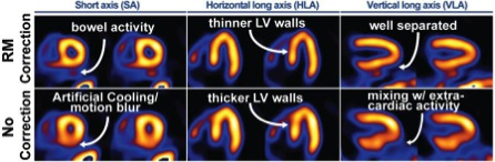 Clinical SPECT