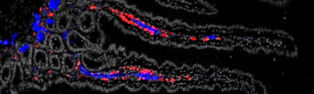 Immunofluorescence mouse intestinal villi