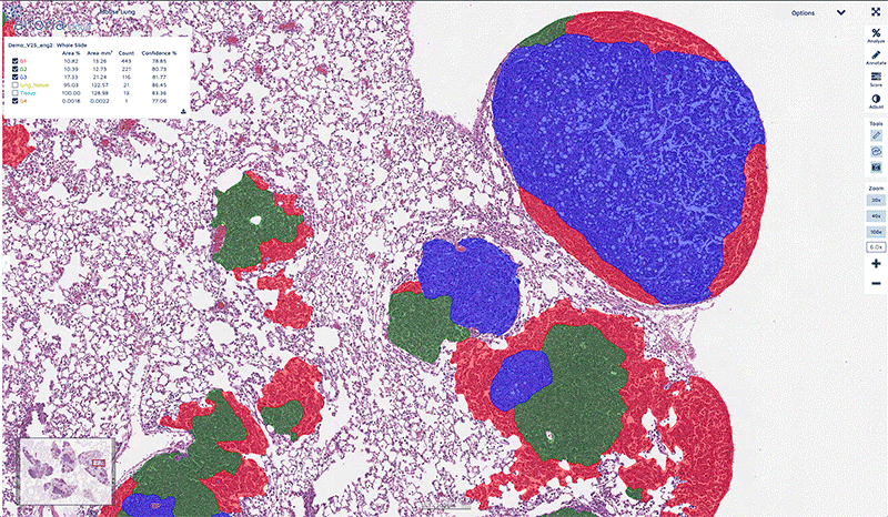 Aiforia segmentation