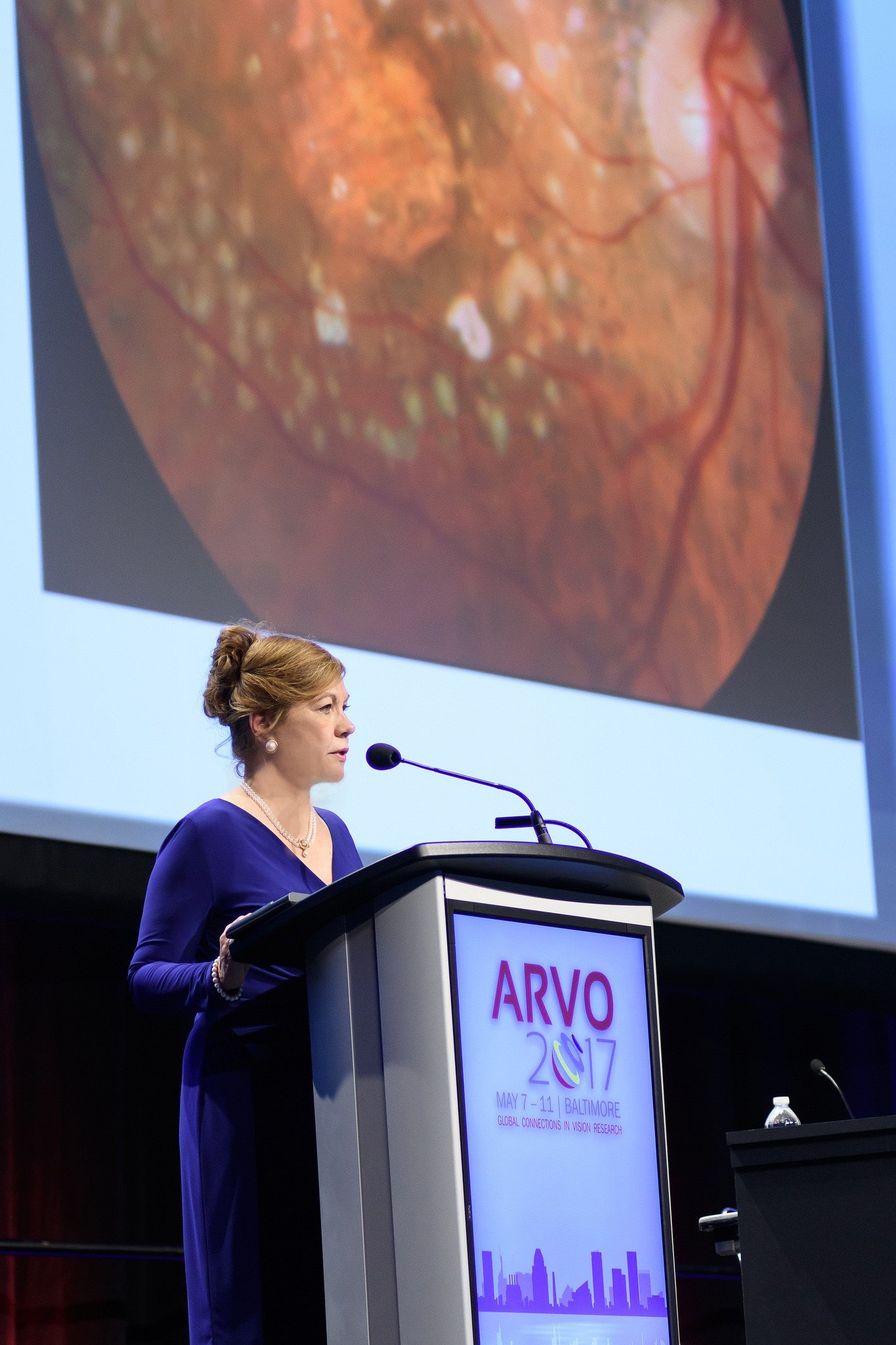 Dr. Johanna Seddon Awarded 2017 ARVO Mildred Weisenfeld Award