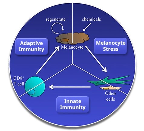 Vitiligo research